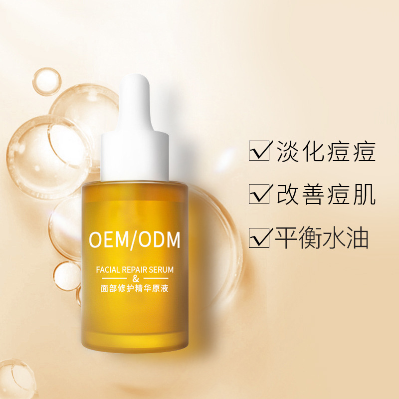 湛江市_祛痘精华原液OEM